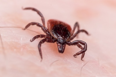 How To Get Rid Of Ticks